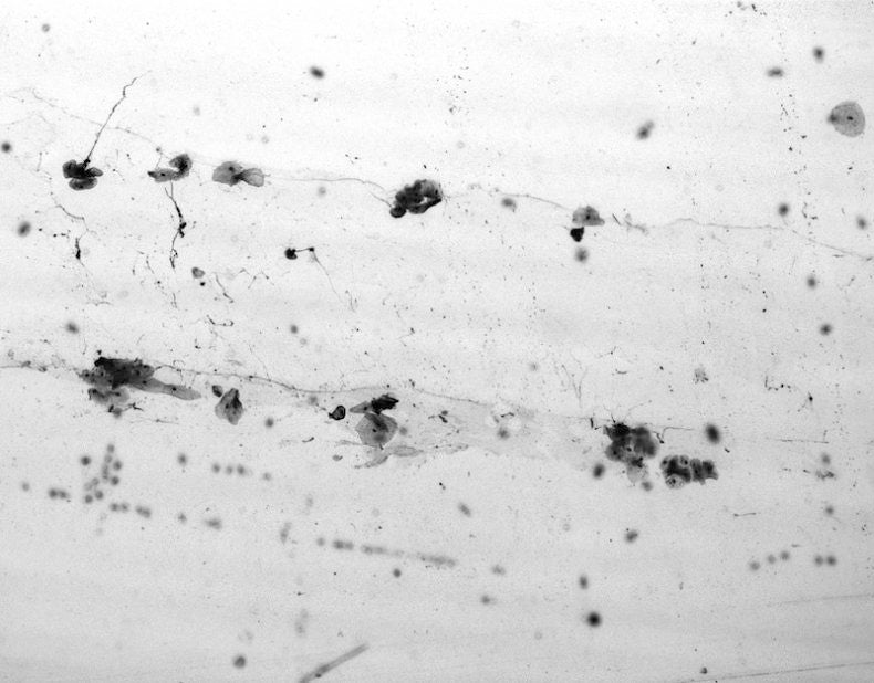 Aleix Plademunt — Almost There