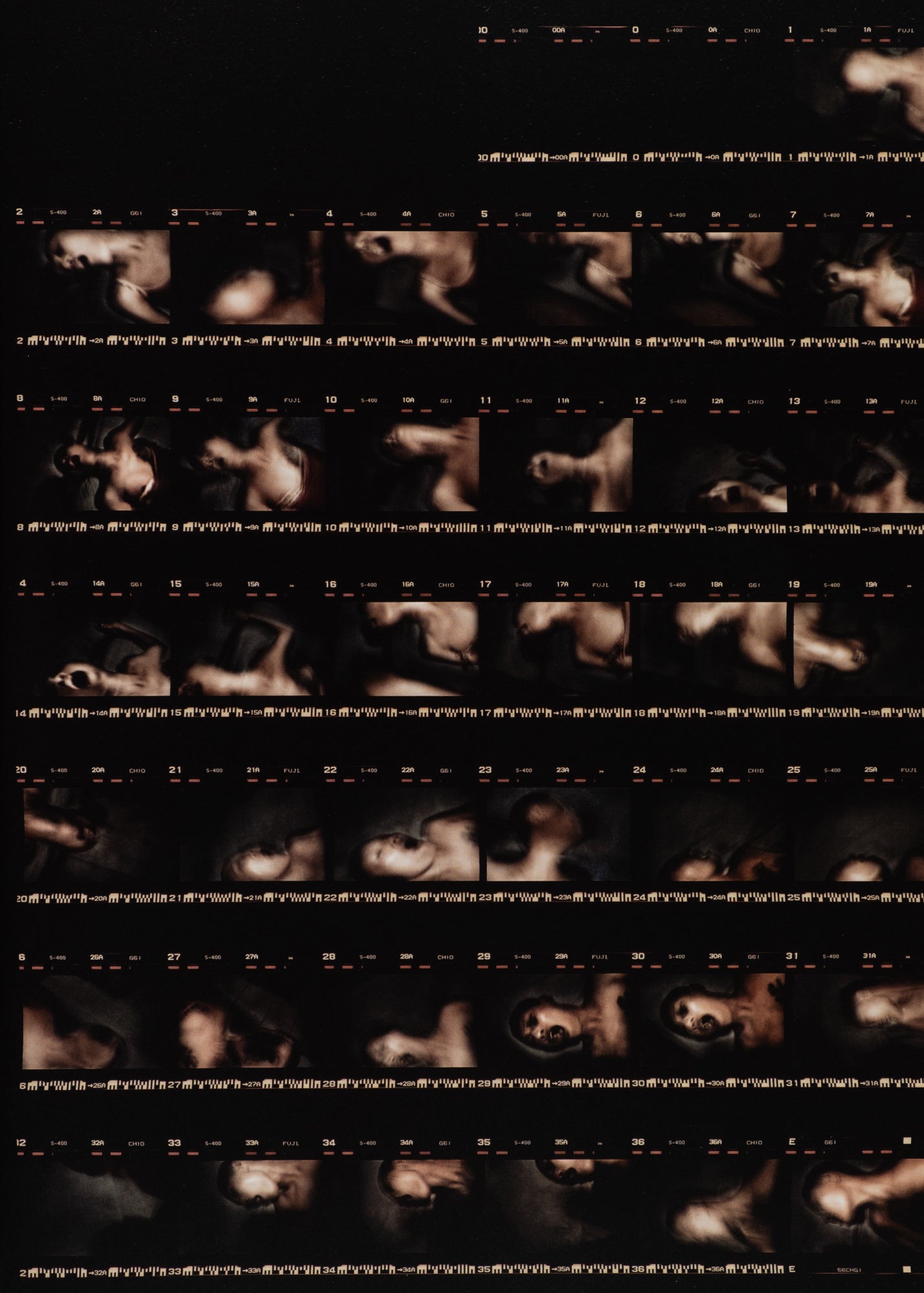 Antoine D'Agata — Anticorps